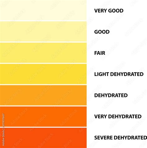 Urine color, Dehydration Urine Color Chart, vector illustration Stock ...