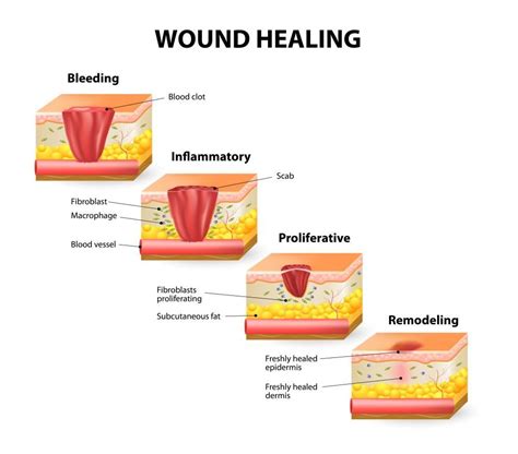 Vitamins, Supplements and Wound healing : Jenna Wishnew, MD, FACS ...