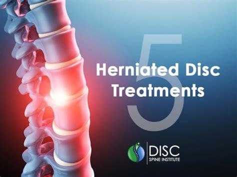 5 Herniated Disc Treatments | DISC Spine Institute TX