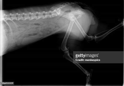 105 Hip Fracture X Ray Stock Photos, High-Res Pictures, and Images ...