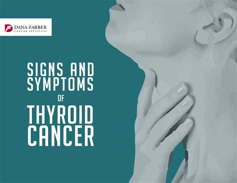 Thyroid Cancer: Symptoms and Signs | Dana-Farber Cancer Institute