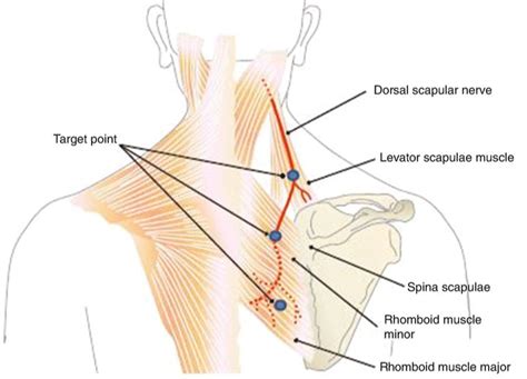 Dorsal Scapular Nerve Cadaver