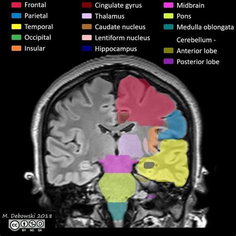 Radiology Imaging, Medical Imaging, Brain Anatomy, Medical Anatomy, Mri ...