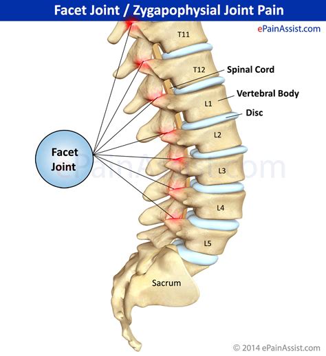 Facet Joint or Zygapophysial Joint Pain: Treatment, Causes, Symptoms