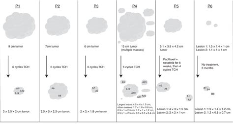 Longitudinal multi-region HER2-positive breast cancer cohort ...