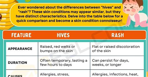 Hives vs. Rash: Identifying the Key Differences • 7ESL