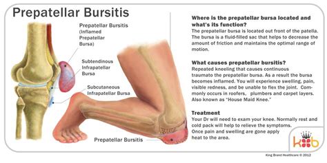 Carpet Layers Knee / Prepatellar Bursitis Wikipedia - Google has many ...