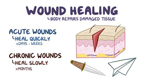 Wound healing: Video, Causes, & Meaning | Osmosis