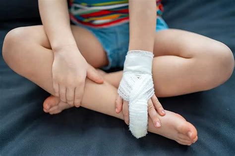 Pediatric Injuries – Wiki Wiki Orthopedics