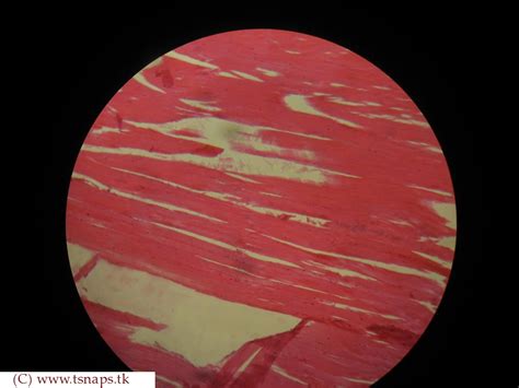 Skeletal Muscle Tissue Histology