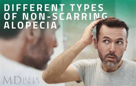 Different Types of Non-Scarring Alopecia • MD Hair Labs