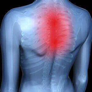 6 Most Common Causes of Middle Back Pain