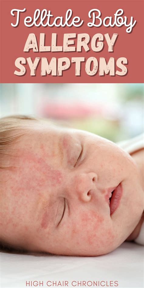 Telltale Baby Food Allergy Symptoms and When to Test!