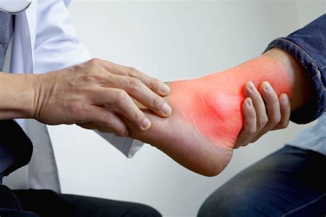 Charcot Foot Surgery | Certified Foot and Ankle Specialists Boca Raton, Fl