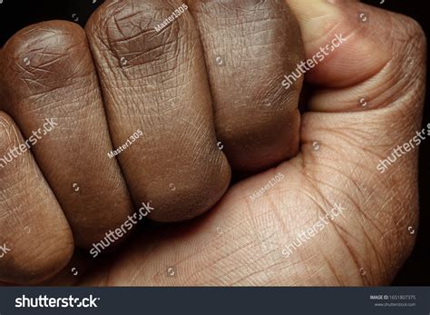 Hand Detailed Texture Human Skin Close Stock Photo 1651807375 ...