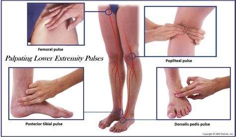 Posterior Tibialis Pulse