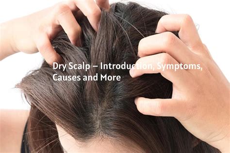 Dry Scalp – Introduction, Symptoms, Causes and More