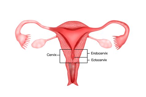 Chapter 13 – Cancer of the Cervix – Melaka Fertility