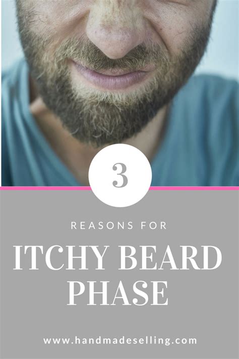 itchy beard phase 2024 ~ handmadeselling.com