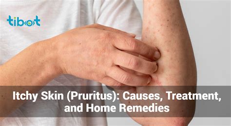 Itchy Skin (Pruritus): Causes, Treatment, and Home Remedies