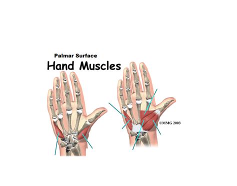 Palmar Hand Muscles Quiz