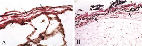 Parietal Pleura Histology