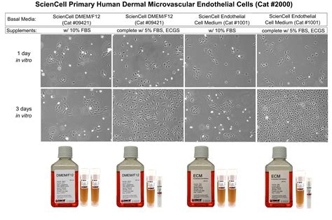 Why is basal media and supplementation important in primary cell ...