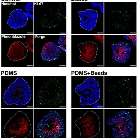 HE staining of spheroids. Spheroids at day 3, 6, and 9 and under each ...