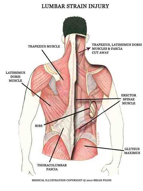 Lower Back Strain Exercises