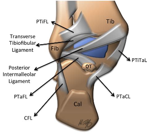 Figure 6 from Magnetic Resonance Imaging of Ankle Ligaments | Semantic ...