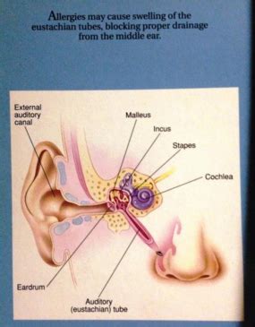 Ear Allergies | Ear Itching | Ear Allergy Testing & Treatments