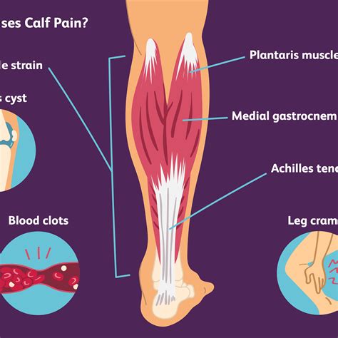 Swirlster First: Calf Tightness And Pain