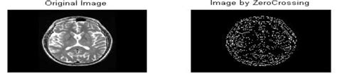 Zero-Crossing Result | Download Scientific Diagram