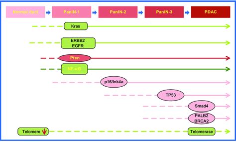 Progression model of pancreatic ductal adenocarcinoma. Progressive ...