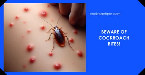 Do cockroaches bite?: The Truth Is Revealed Today - cockroachpro