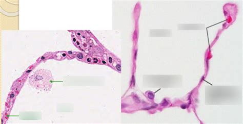 Histology - Alveolus Specimen Diagram | Quizlet