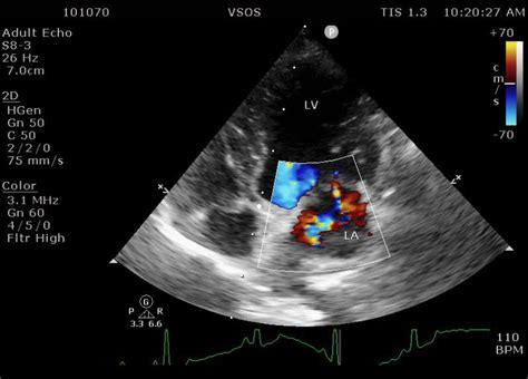 Myxomatous Mitral Valve Degeneration (MMVD) - My Vet Animal Hospital