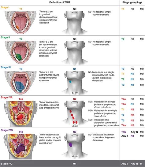 Early stage cancer lymph nodes in neck - allthingspoliz