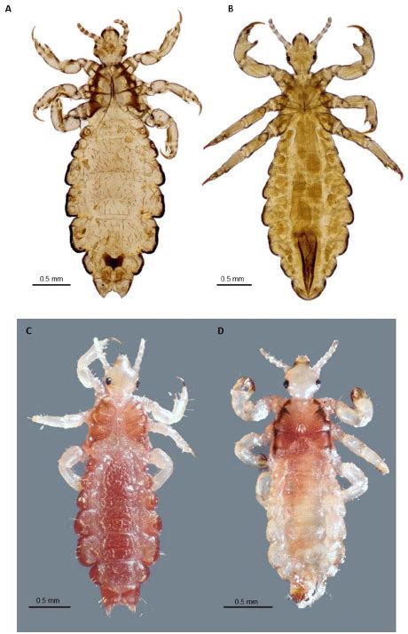 Adult body louse and head lice. A. Ventral view of slide- mounted ...