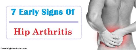 7 Most Common Early Signs Of Hip Arthritis - Cure My Joint Pain