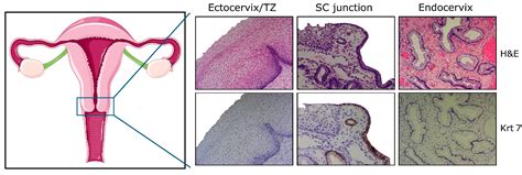 Endocervix Histology