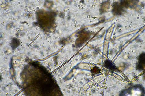 Fungal and Fungi Hyphae Under the Microscope in the Soil and Compost ...