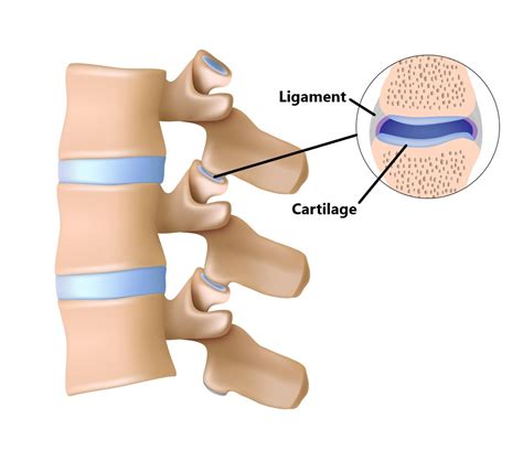 Facet Joint Injuries - My Family Physio