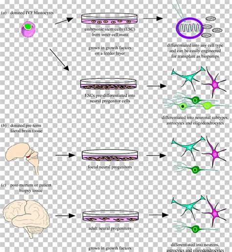 Neurodegeneration Stem Cell Stem-cell Therapy Brain PNG, Clipart, Angle ...