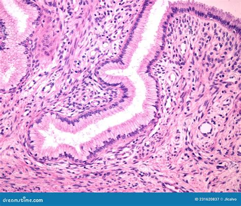 Endocervix Histology