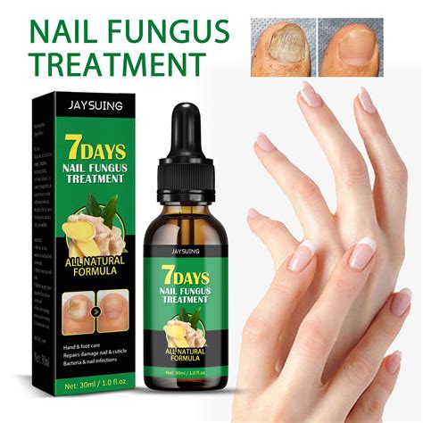 Hand Nail Fungus