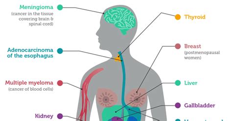 Cancers Associated with Overweight and Obesity Infographic - National ...