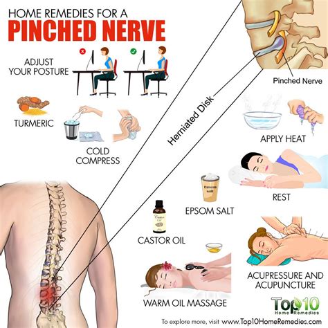 How To Help A Pinched Nerve | Examples and Forms