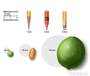 Breast Cancer Stages | Texas Breast Specialists