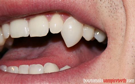 how to make vampire teeth | Archive Uncategorized